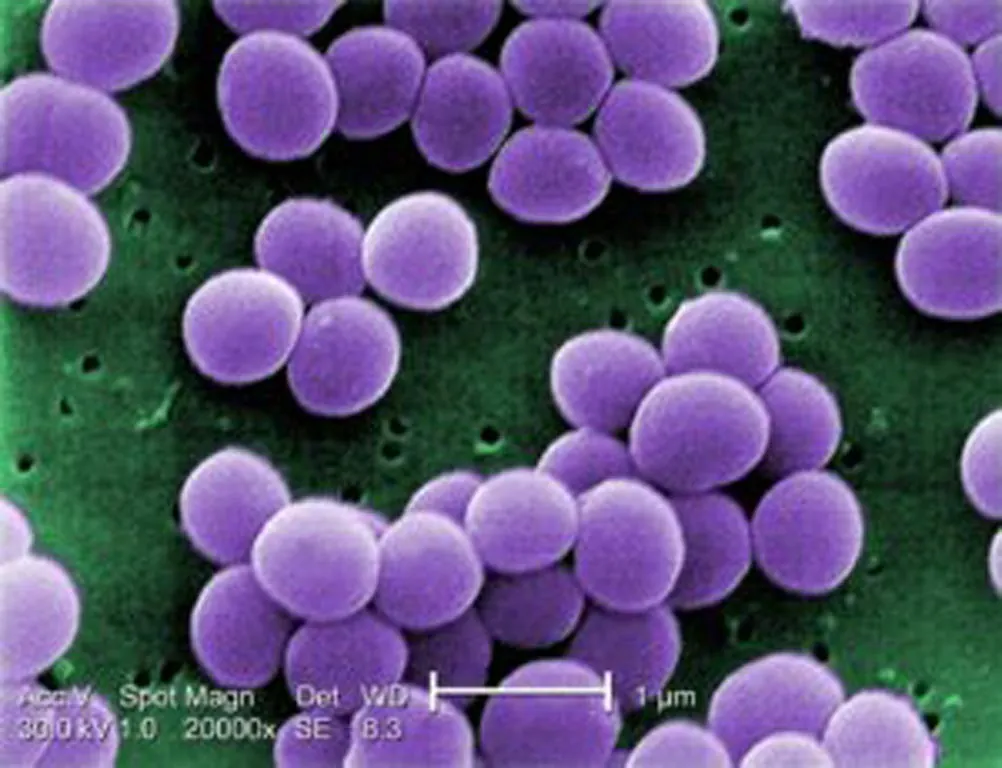 Staphylococcus_aureus